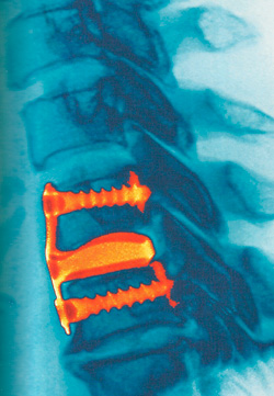 спина рентгенограмма