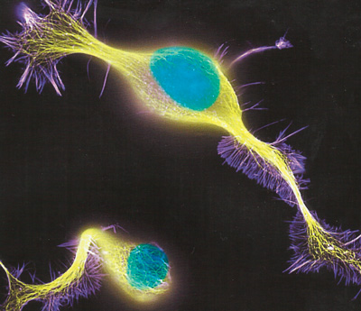 нервные клетки фото