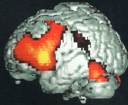 схема коры головного мозга