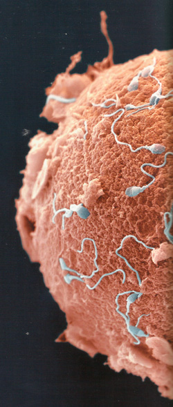 Сперматозоиды пытаются проникнуть в яйцеклетку