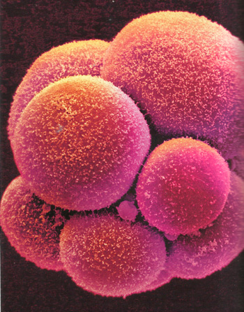 эмбрион фото