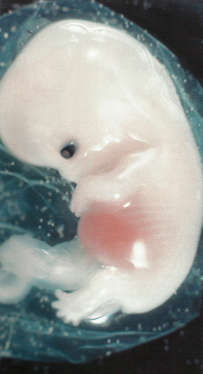 эмбрион 4 недели