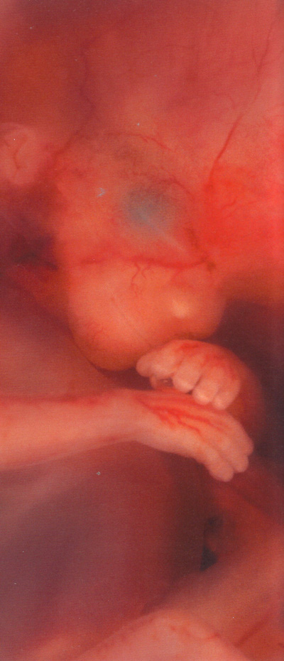 Эмбрион фото