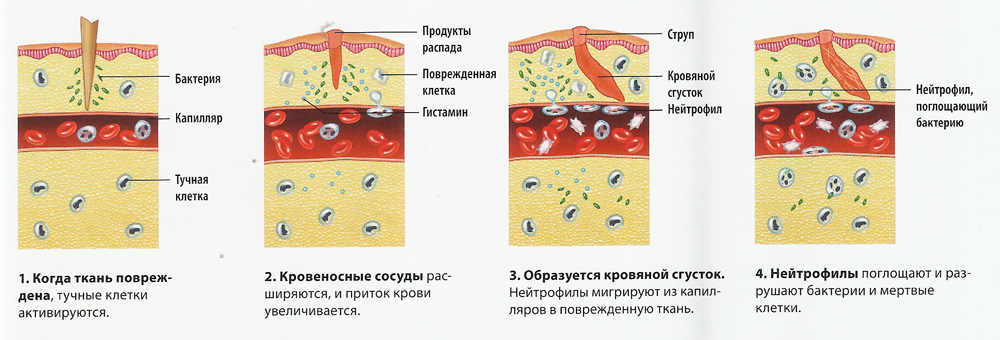 Рассмотрите схему воспалительного процесса